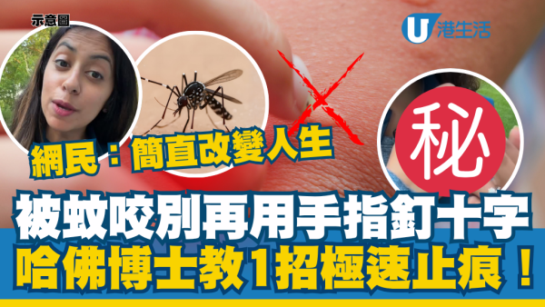 被蚊咬別再用手指釘十字！哈佛博士教1招極速止痕！網民：簡直改變人生