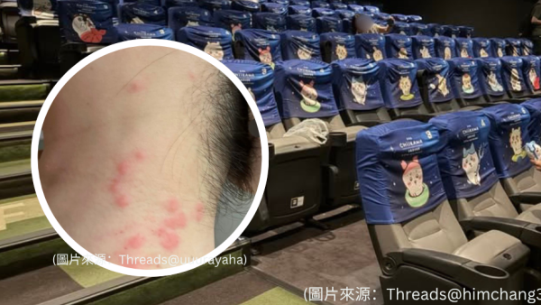 將軍澳戲院睇戲慘變「獻血」！港女頸部疑被床蝨咬爆10處紅腫 專家教1招徹底滅蝨