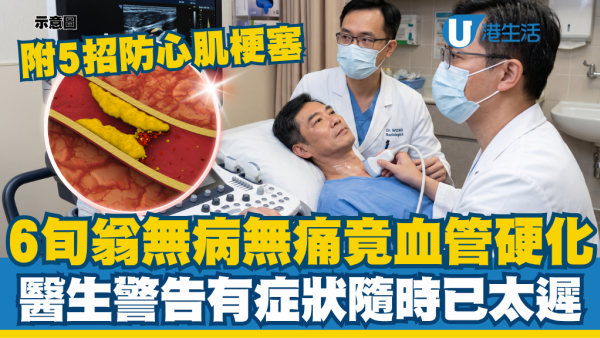 6旬翁無病無痛體檢驚見血管硬化！醫生警告有症狀已太遲：傳授5招防心肌梗塞
