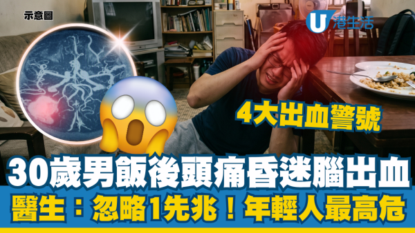 30歲男子飯後頭痛頭暈驚爆腦出血！醫生：別以為只是暈碳！附4大高危警號求救