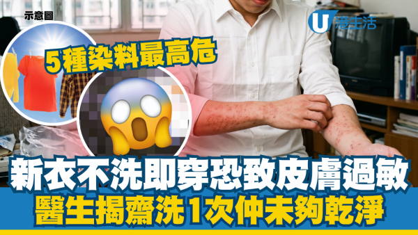 穿新衫要先洗一次嗎？男子即買即穿爆皮膚炎！醫生揭3大洗滌法則：5種染料最高危