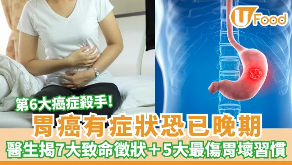 胃癌有症狀恐已晚期！醫生揭7大致命徵狀＋5大最傷胃壞習慣