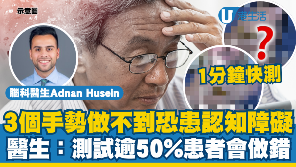 大脑自测｜3个手势做不到恐患认知障碍！医生教路1分钟快测：逾50%患者做错