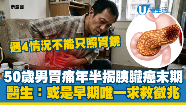 50歲男以為胃痛拖年半變末期胰臟癌！醫生揭癌王唯一救命警號：單照胃鏡無用