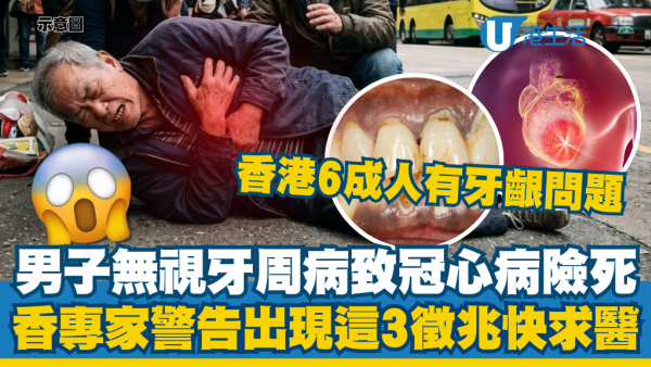 香港6成人有牙龈问题！男子无视牙周病致冠心病险死！专家警告出现这3征兆快求医