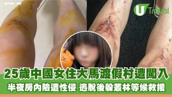 25歲中國女住大馬渡假村遭闖入！半夜房內險遭性侵 逃脫後躲叢林等候救援