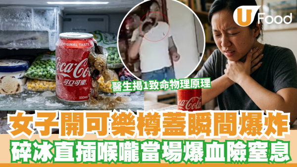 可樂禁忌｜女子開可樂樽蓋瞬間爆炸 碎冰直插喉嚨當場爆血 醫生揭1致命原理