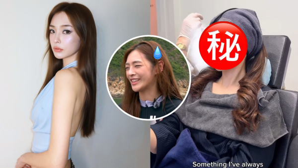 陈桢怡震撼公开韩国医美过程，曝光真面目！素颜惊现欧式双眼皮与丰唇神奇进化