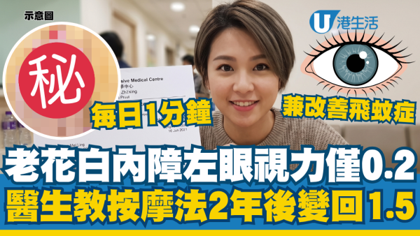 女子老花白内障左眼视力仅0.2！医生教按摩法2年后变回1.5：每日1分钟救眼兼改善飞蚊症