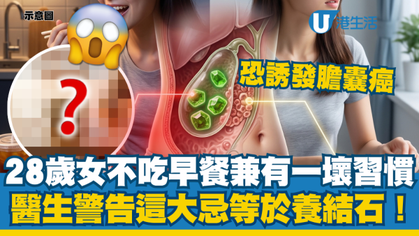 28歲女從不吃早餐兼有一壞習慣！醫生警告這大忌等於養結石：恐誘發膽囊癌