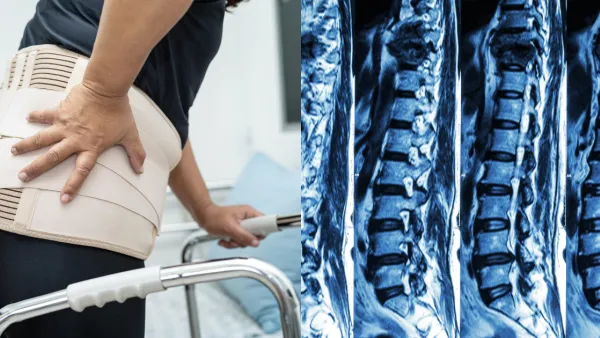 30歲醫生腰痛墊枕頭睡覺紓緩導致癱瘓！大小便失禁須緊急手術搶救