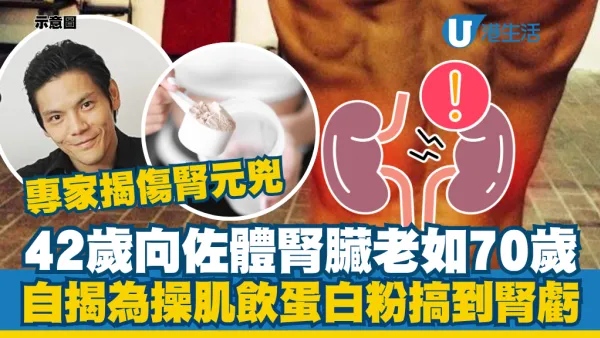 42岁向佐肾脏老如70岁！自揭喝蛋白粉搞到肾亏：专家揭另有2物为伤肾元凶！