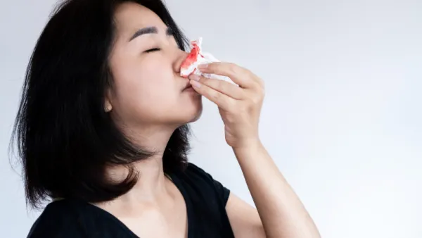 天氣乾燥經常流鼻血？網民狂推1款平民潤鼻膏：耳鼻喉專科都開依隻