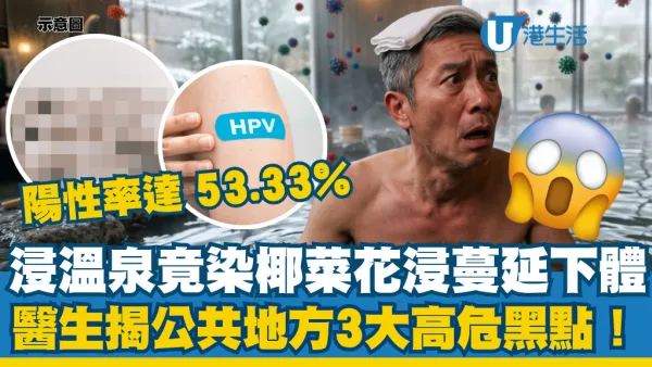 浸溫泉惹椰菜花蔓延下體！醫生揭公共地方3大高危黑點：陽性率高達53.33%