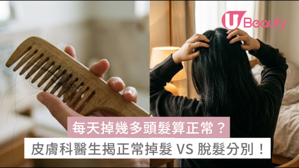 每天掉幾多頭髮算正常？皮膚科醫生拆解正常掉髮 VS 脫髮分別！教你「10秒在家拉髮測試」