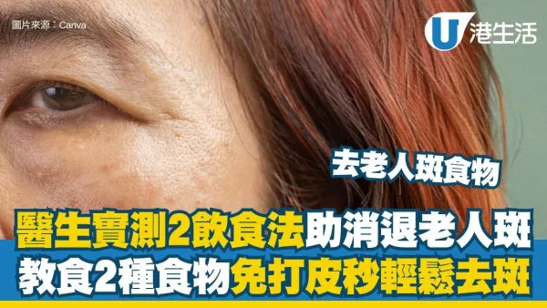 去老年斑食物：75岁医生实测2饮食法助消退老年斑 教吃2种食物免打皮秒轻松去斑