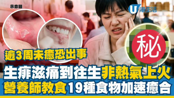 生痱滋、生唇瘡、嘴角裂分不清？營養師公揭3大分別特徵 附19種加速癒合食物清單