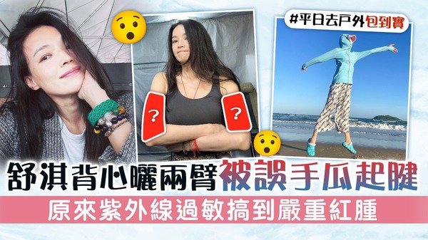 舒淇背心曬兩臂被誤手瓜起腱 原來紫外線過敏搞到嚴重紅腫