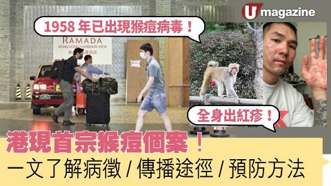 港現首宗猴痘個案！ 一文了解病徵/傳播途徑/預防方法　
