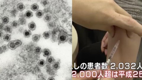 日本德國麻疹疫情持續蔓延 東京、大阪、福岡過2000人中招