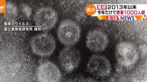 日本德國麻疹個案飆升 今年過1000人感染創6年來新高