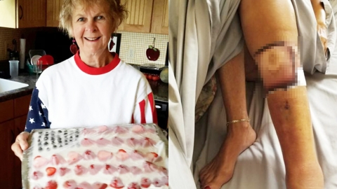 全球暖化海水升溫成惡菌溫床 美婦海灘散步染食肉菌身亡