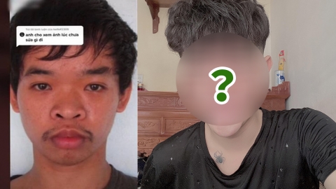 越南男多次見工失敗被嘲太醜 砸4億全臉大整容9次重獲新生