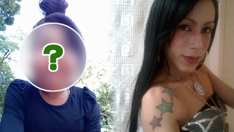 巴西女子整容貪平變「鬼面具」 望眾籌手術費終失敗宣告放棄治療