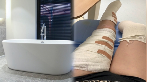 有傷口去Staycation浸浴易出事 25歲女細菌感染要截肢（APP限定）