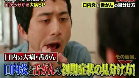 痱滋、舌癌都有白點易混淆！ 日本醫生教認清3大分別（APP限定）