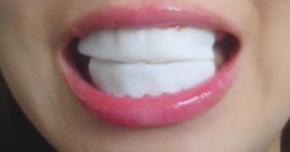 日本平價好用美白牙貼 用一次3分鐘見效！牙齒由黃變白
