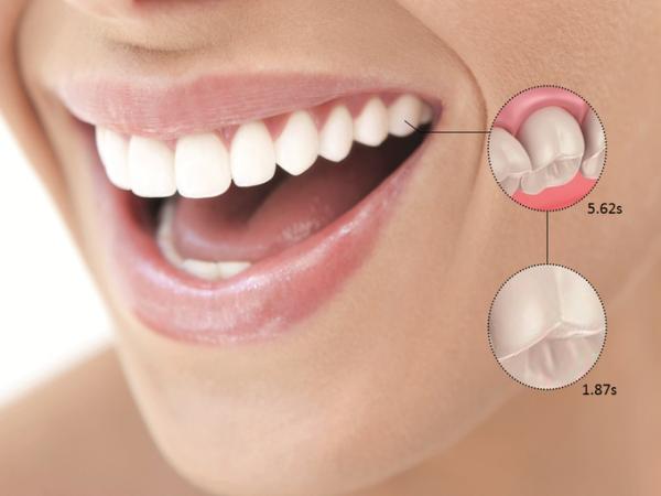 設計網站指每隻牙齒需用 5.62 秒清潔，而每隻牙齒表面需要1.87 秒清潔。