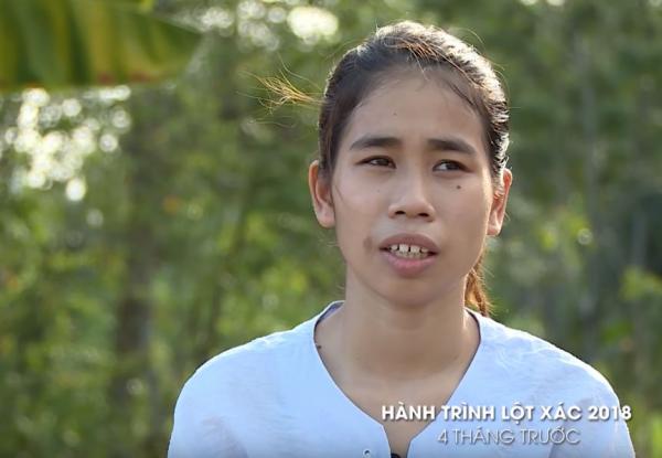 越南女因貌醜求職屢遭拒 整容變美女 聾啞母拒認：這不是我女兒