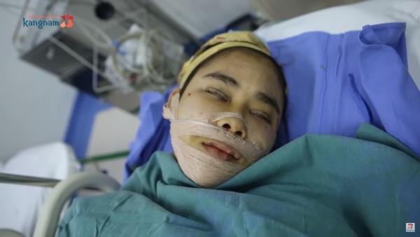 越南女因貌醜求職屢遭拒 整容變美女 聾啞母拒認：這不是我女兒