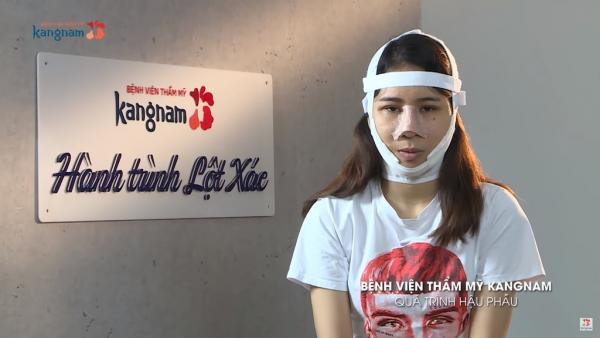 越南女因貌醜求職屢遭拒 整容變美女 聾啞母拒認：這不是我女兒